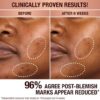 DARK SPOT SERUM & Charlotte's Magic Cream DUO hudpleiesett